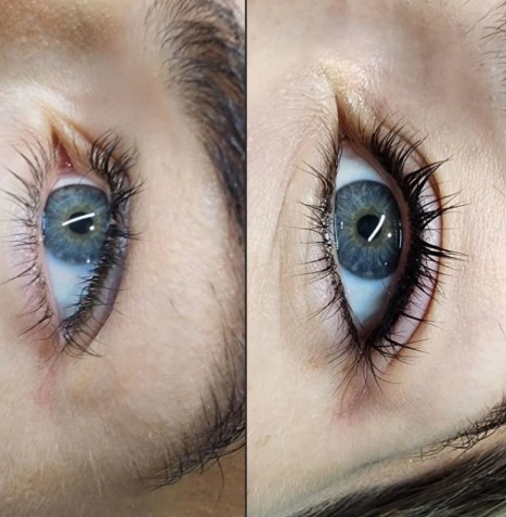 Eyelash Enhancement
